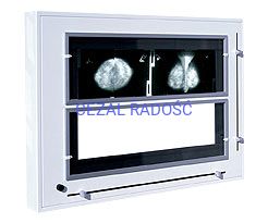 Negatoskop żaluzjowy do mammografii NGP-31m Z – najpopularniejszy negatoskop do mammografii w Polsce