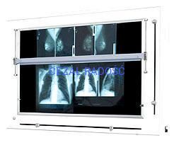 Negatoskop żaluzjowy do mammografii NGP-41m ZU