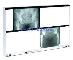 Negatoskop wysokiej częstotliwości NGP-1000 R HF