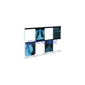 Negatoskop wysokiej częstotliwości NGP-80 HF