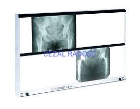 Negatoskop wysokiej częstotliwości NGP-800 HF