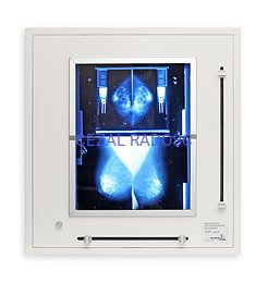 Negatoskop żaluzjowy do mammografii NGP-21m Z