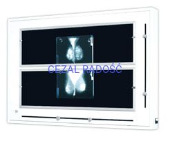 Negatoskop żaluzjowy do mammografii NGP-41m Z